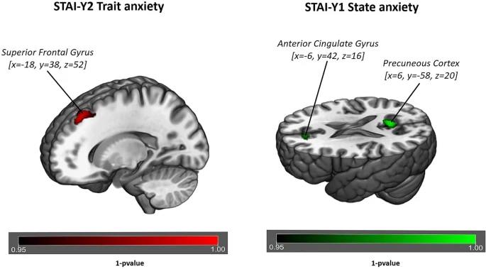 Impacto de la ansiedad rasgo y estado en el cerebro